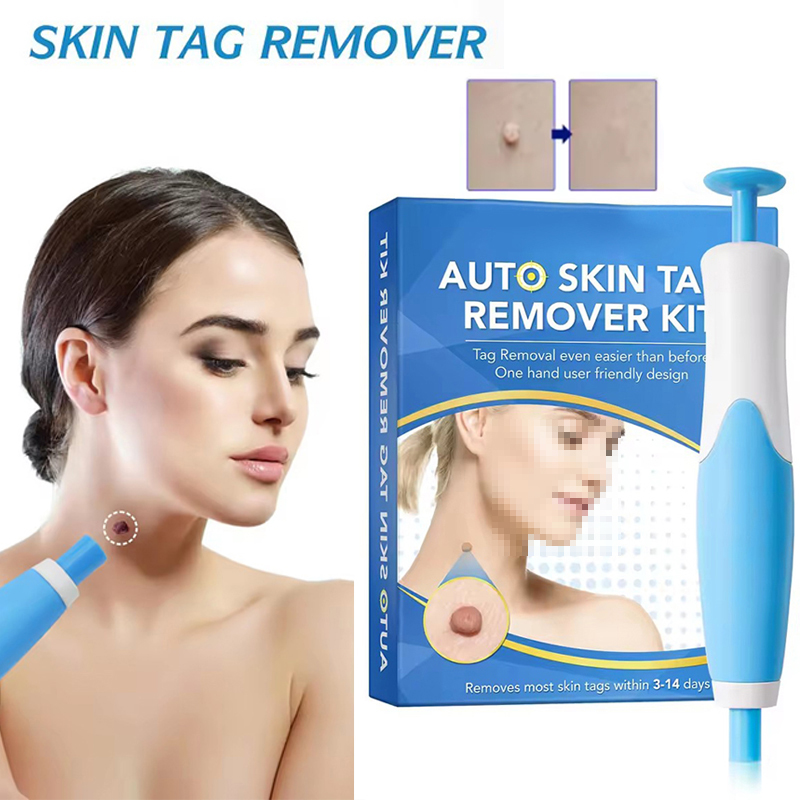 2-in-1 Auto-Hautanhängsel-Entf – Luxury Skincare Acne Bewertung und Preis